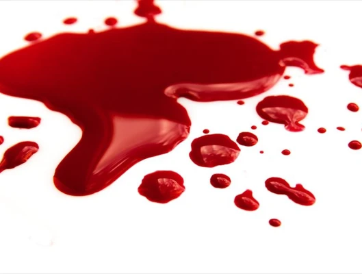 Ακόμη ένα εργατικό δυστύχημα σημειώθηκε σε καρνάγιο στον Αλμυρό Βόλου